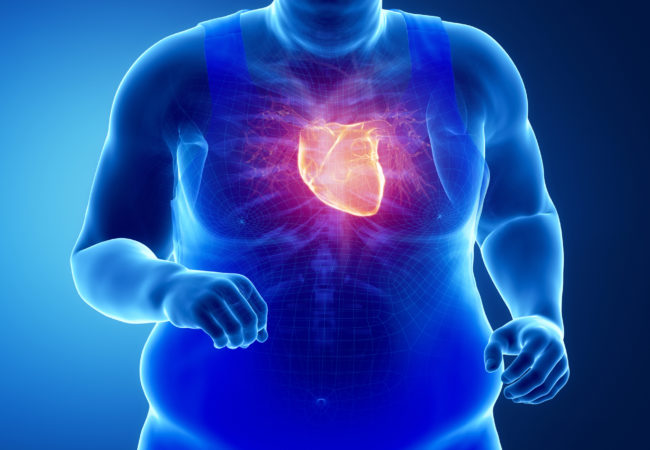 ما هي العلاقة بين السمنة وأمراض القلب؟